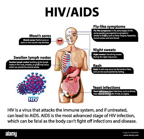 the impact of insurance on hiv testing|THE IMPACT OF INSURANCE AND HIV TREATMENT .